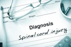 Bloomingdale spinal cord injury attorney, spinal cord injuries